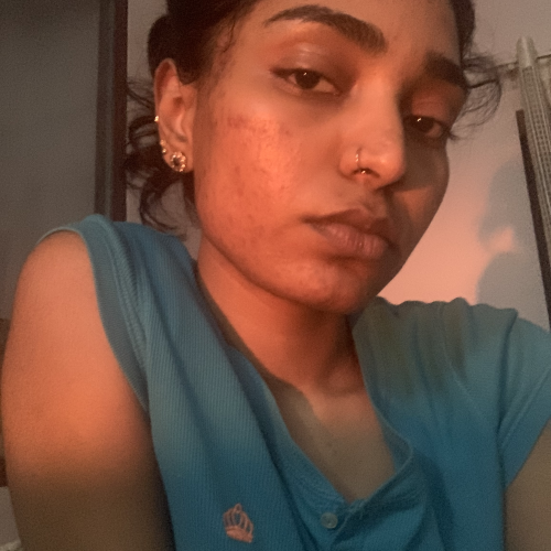 Vidya D.
