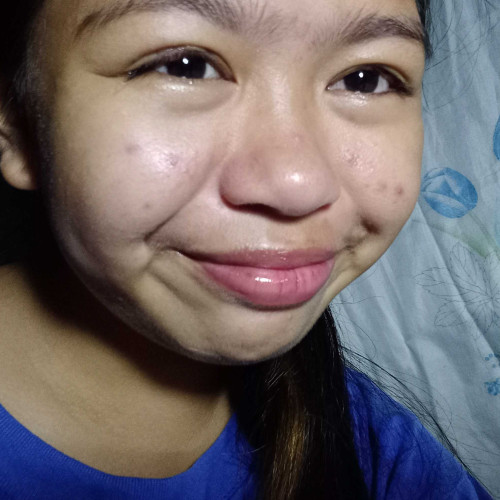 Isol S.