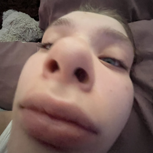 Abby c.