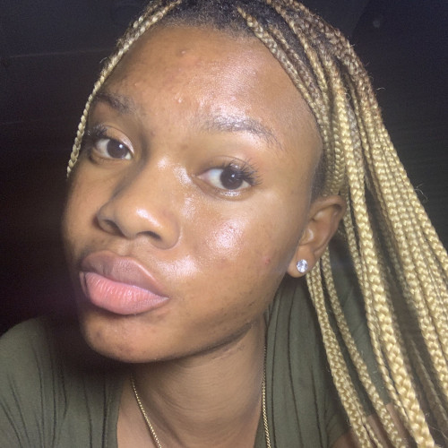 mercy o.