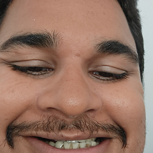 Abraar M.