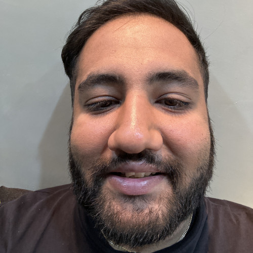 Akash J.
